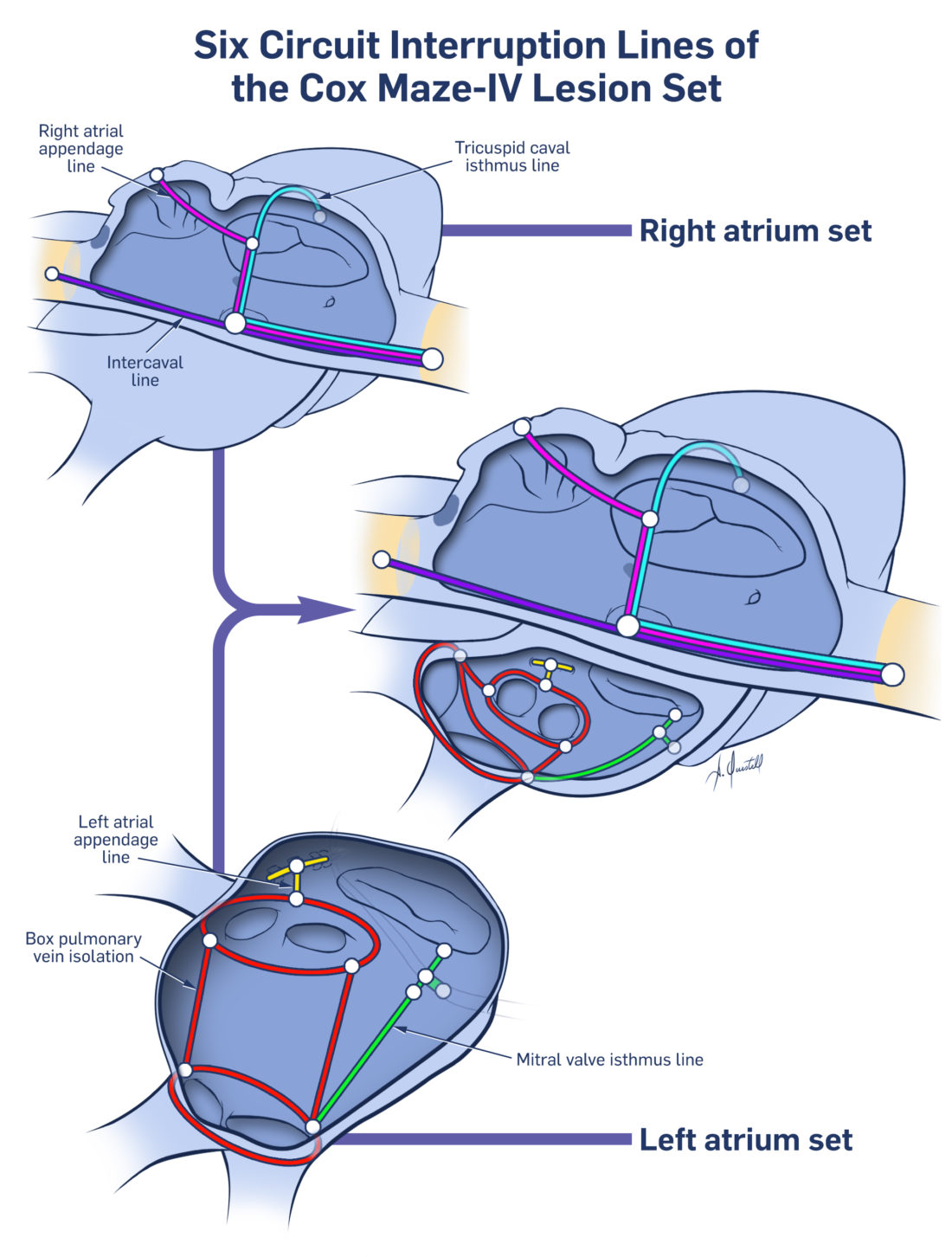 Maze Procedure Lines A KYU Design